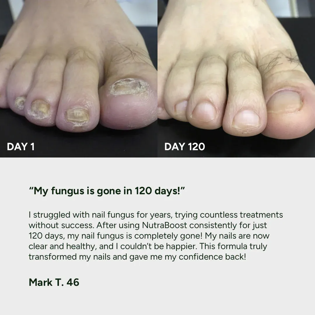 imgi_10_nail-fungus-treatment-gel-review.webp