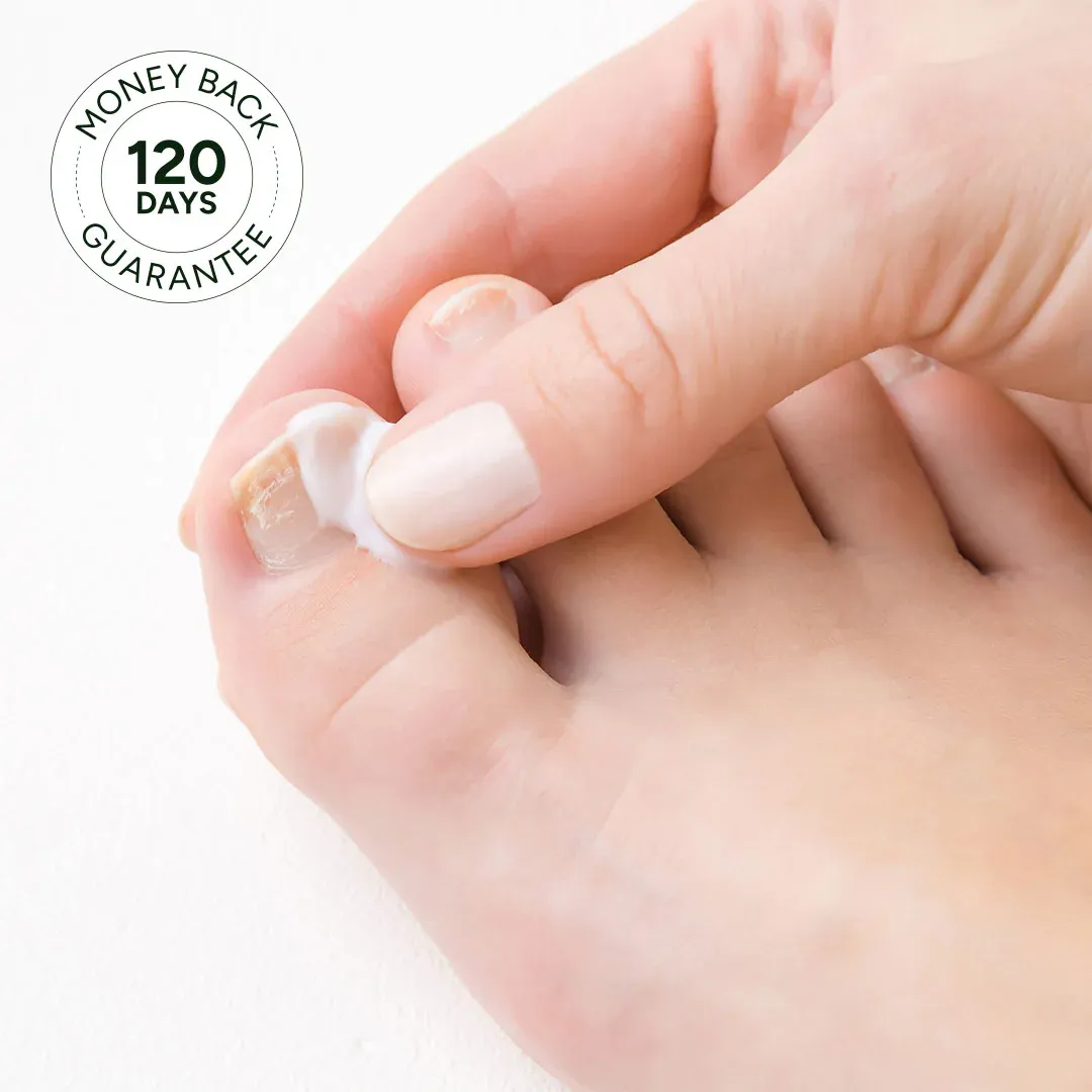 imgi_46_nail-fungus-treatment-gel-faqs.webp